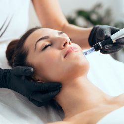 microneedling